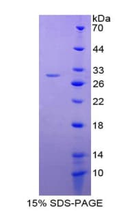 Rat GSTA4 Protein (Recombinant His-T7)