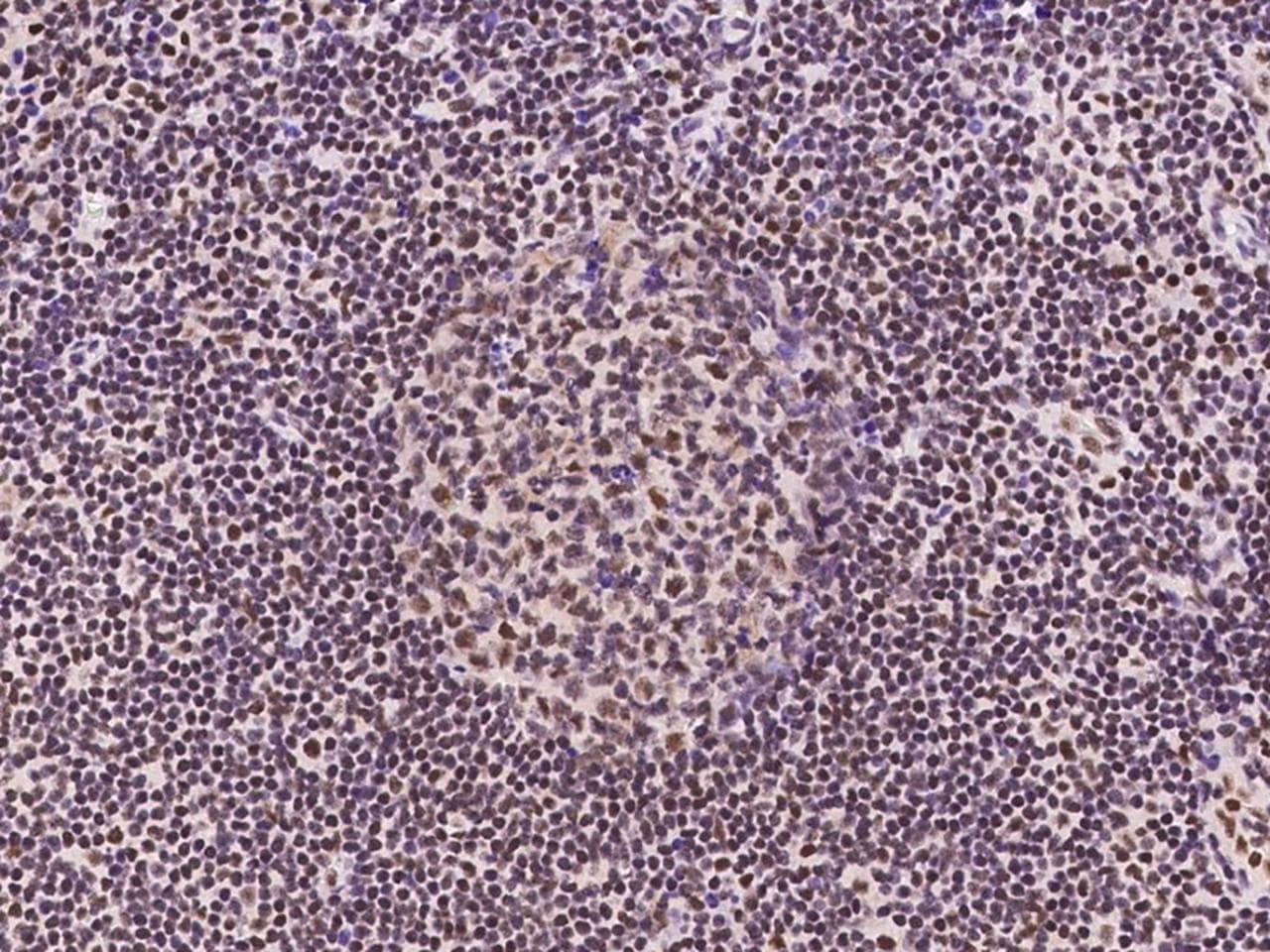 Polyclonal Rabbit anti-Human RNF113A Antibody (IHC, IF)