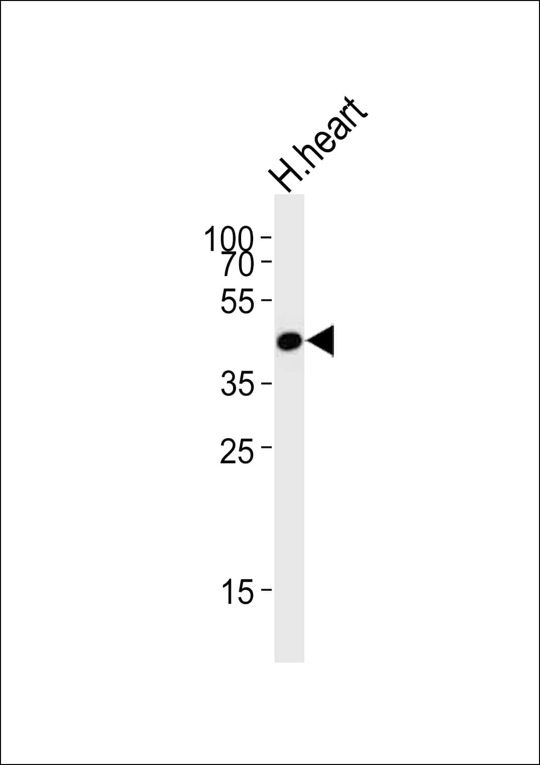 QTRT1 Antibody (aa303-337)