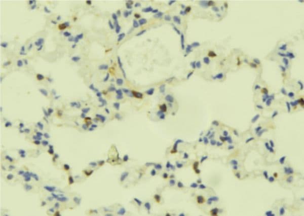 PLCE1 Antibody