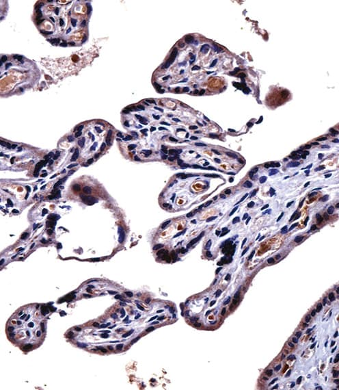 IL9R / CD129 Antibody (aa170-199)