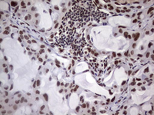 Monoclonal Mouse anti-Human C14orf166 Antibody (clone OTI1G8, IHC, WB)