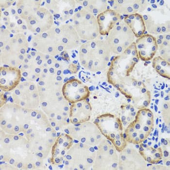 Polyclonal Rabbit anti-Human MTERF2 / MTERFD3 Antibody (IHC, WB)