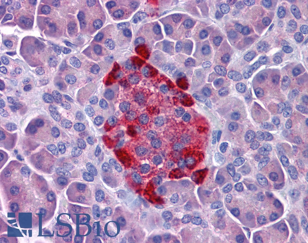 IHC-plus™ Polyclonal Rabbit anti-Human MFSD1 Antibody (IHC, WB)