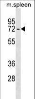 Polyclonal Rabbit anti-Human ENTPD4 / LALP70 Antibody (aa40-69, WB)