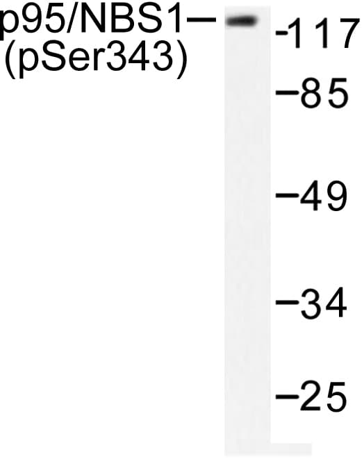 NBN / Nibrin Antibody (phospho-Ser343)
