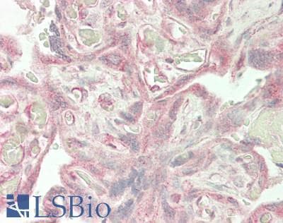 IHC-plus™ TIMP2 Antibody (aa 30-220)