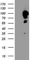 CAST / Calpastatin Antibody (clone OTI1E7)