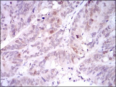 Monoclonal Mouse anti-Human PLK1 / PLK-1 Antibody (clone 3C11, IHC, WB)