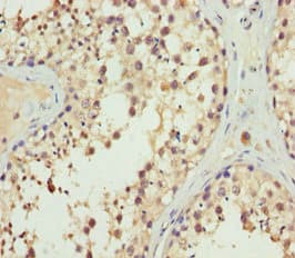 Polyclonal Rabbit anti-Human SPFH2 / ERLIN2 Antibody (IHC, WB)