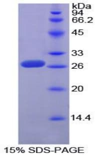 Mouse SP100 Protein (Recombinant His-T7)