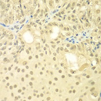 TBL1XR1 / TBLR1 Antibody