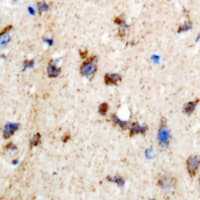 Polyclonal Rabbit anti-Human INPP5K / SKIP Antibody (IHC, WB)