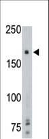 PTPRG / RPTR-Gamma Antibody (aa751-782)