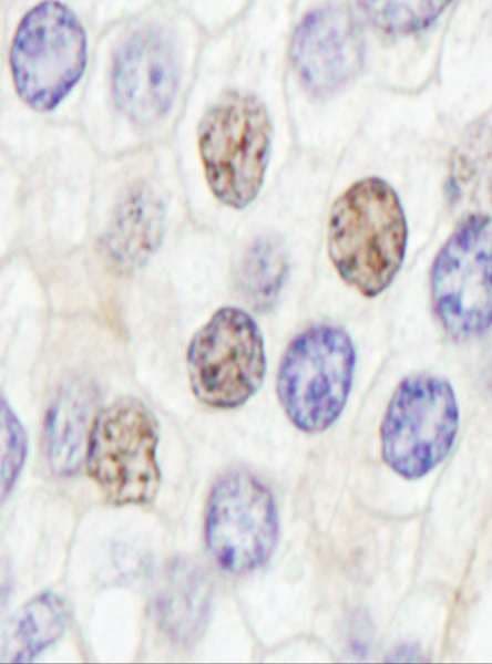 Polyclonal Rabbit anti-Human GTF3 / GTF2IRD1 Antibody (aa650-700, IHC)