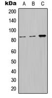 NPHP1 / Nephronophthisis Antibody (Internal)