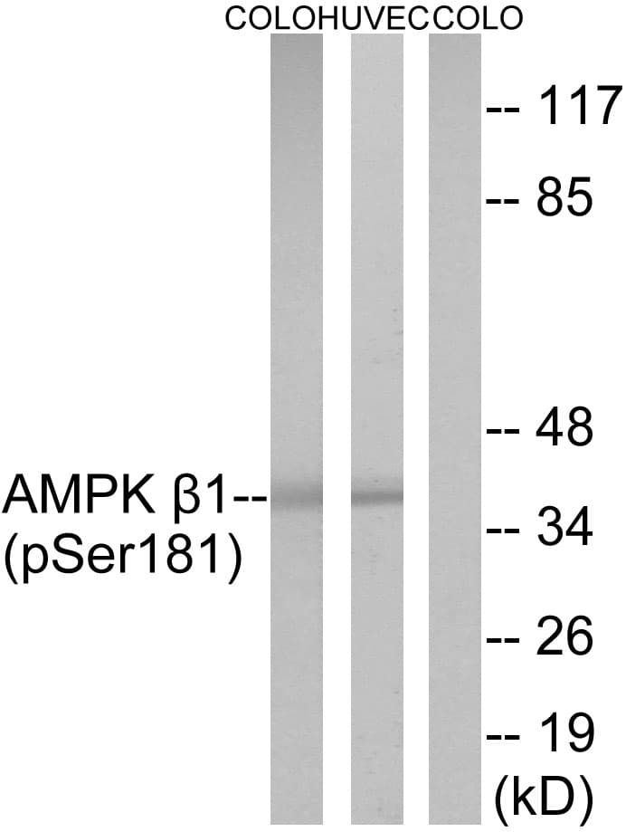 PRKAB1 / AMPK Beta 1 Antibody (phospho-Ser181)