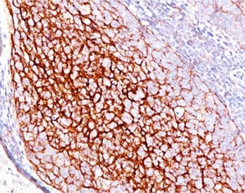 CR1 / CD35 Antibody (clone E11)
