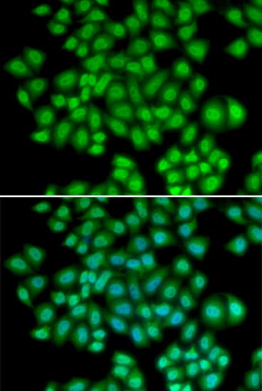 ATF2 Antibody