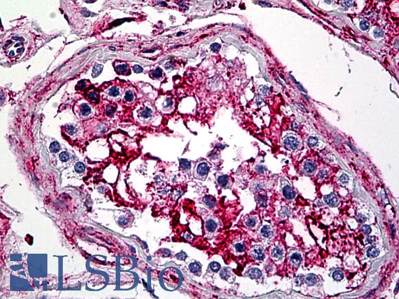 IHC-plus™ Monoclonal Mouse anti-Human ANXA5 / Annexin V Antibody (clone 1F4-1A5, IHC, IF, WB)