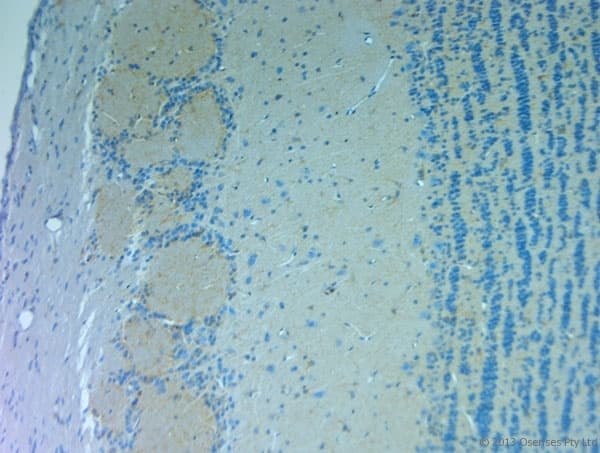 Polyclonal Rabbit anti-Rat GRIN3A / NR3A Antibody (aa1091-1135, IHC)