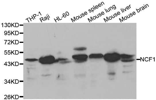 Polyclonal Rabbit anti-Human NCF1 / p47phox / p47 phox Antibody (WB)