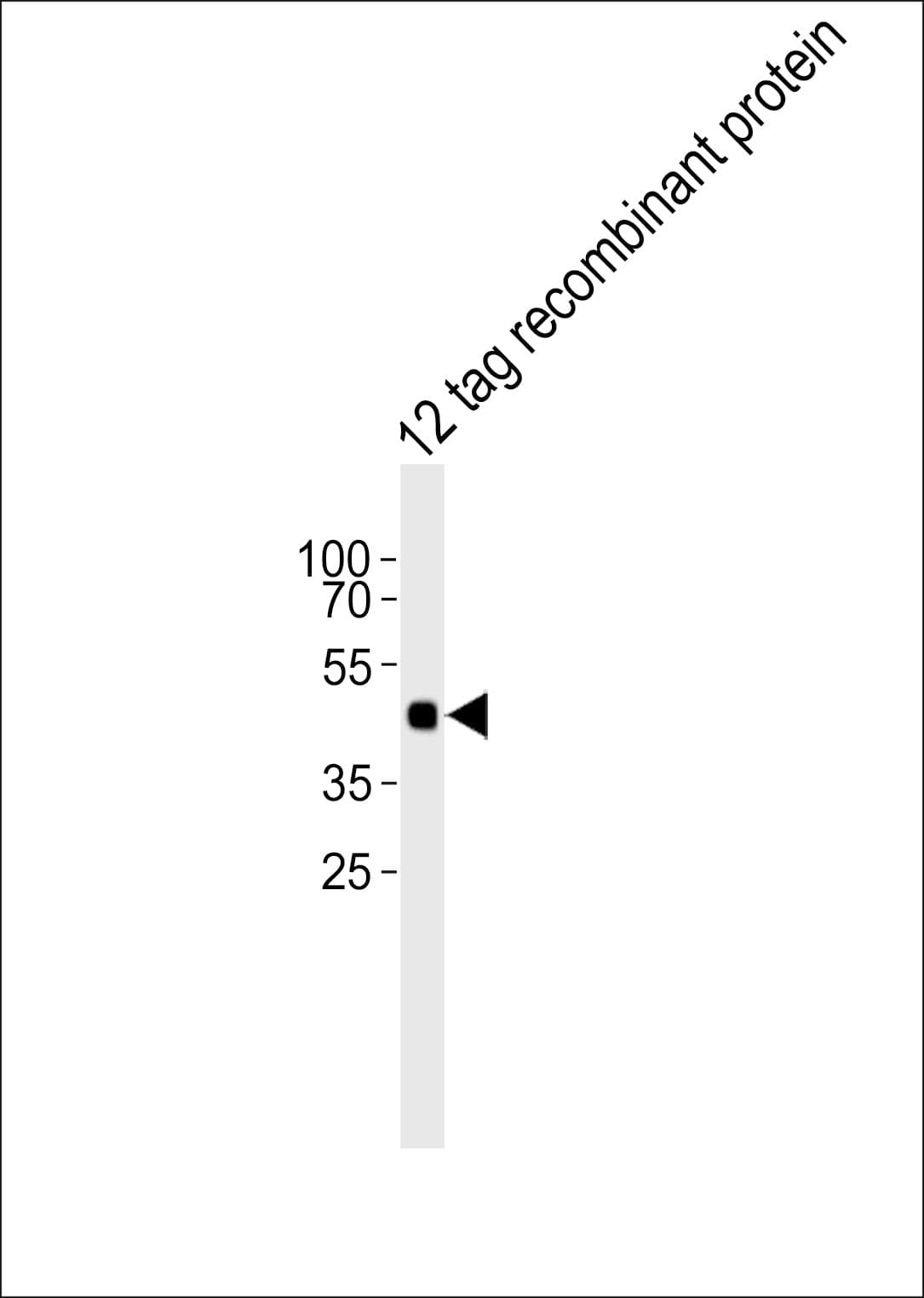 Hemagglutinin / HA Tag Antibody