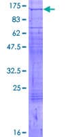 Human ATP2A1 / SERCA1 Protein (Recombinant GST)