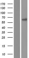 PNPLA1 Protein (Over-Expression Lysate Myc-DDK (Flag))