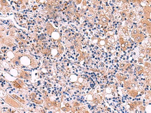 LIPA / Lysosomal Acid Lipase Antibody