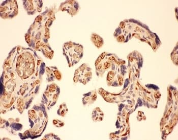 Polyclonal Rabbit anti-Human MMP7 / Matrilysin Antibody (aa1-267, IHC, WB)