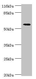 Polyclonal Rabbit anti-Human ACBD5 Antibody (aa1-461, WB)
