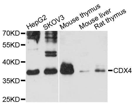 Polyclonal Rabbit anti-Human CDX4 Antibody (WB)