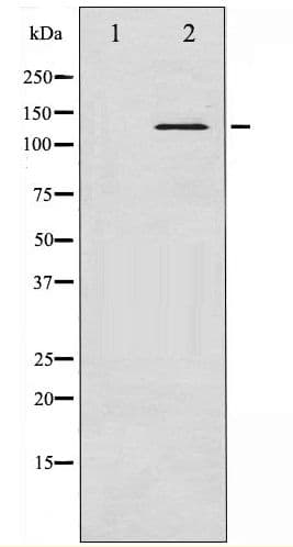 Polyclonal Rabbit anti-Human ABL1 / c-ABL Antibody (phospho-Tyr245, IF, WB)
