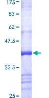 Human IDS / Iduronate 2 Sulfatase Protein (Recombinant GST, N-terminus)