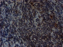 SNAI2 / SLUG Antibody (clone OTI1A6)
