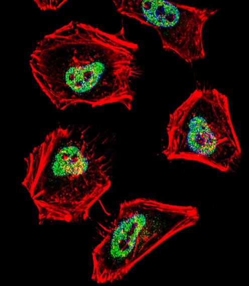 N-CoR / NCOR1 Antibody (aa16-47)