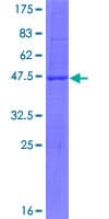 Human SBNO1 Protein (Recombinant GST)