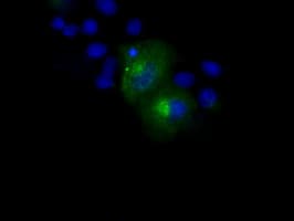 Monoclonal Mouse anti-Human APP / Beta Amyloid Precursor Antibody (clone OTI9E2, IHC, IF, WB)