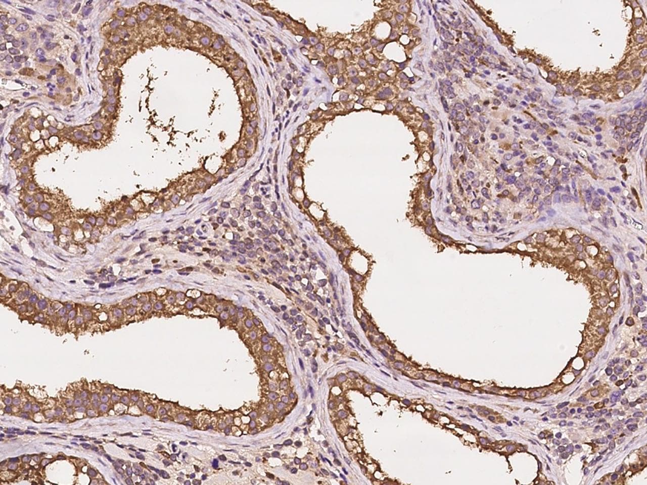 GNPDA2 Antibody