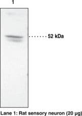 PTGER2 / EP2 Antibody
