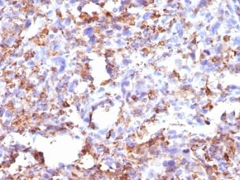 CD68 Antibody (clone CD68/G2, Ready-to-Use)