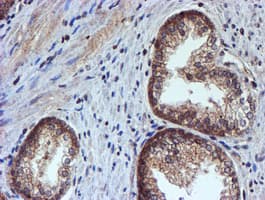 HARS2 Antibody (clone OTI5H2)