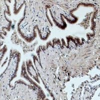Monoclonal Mouse anti-Human FCGR3A / CD16A Antibody (IHC, WB)