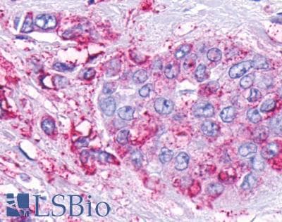 PathPlus™ Polyclonal Rabbit anti-Human GPR161 Antibody (C-Terminus, IHC)