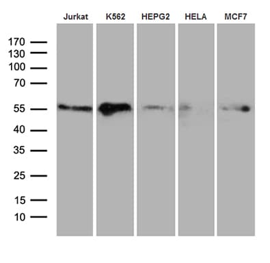 Monoclonal Mouse anti-Human RING1 Antibody (clone OTI11G7, aa88-362, IHC, WB)