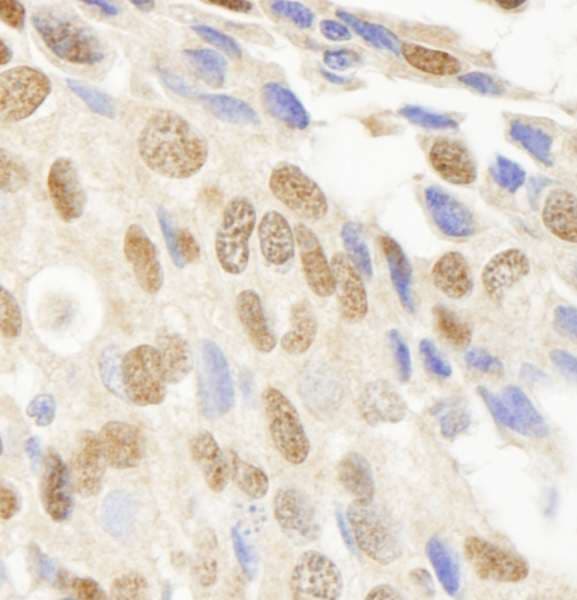 Polyclonal Rabbit anti-Human JHDM1A / KDM2A Antibody (aa825-875, IHC)