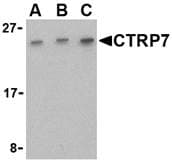 Polyclonal Rabbit anti-Human C1QTNF7 / CTRP7 Antibody (IF, WB)