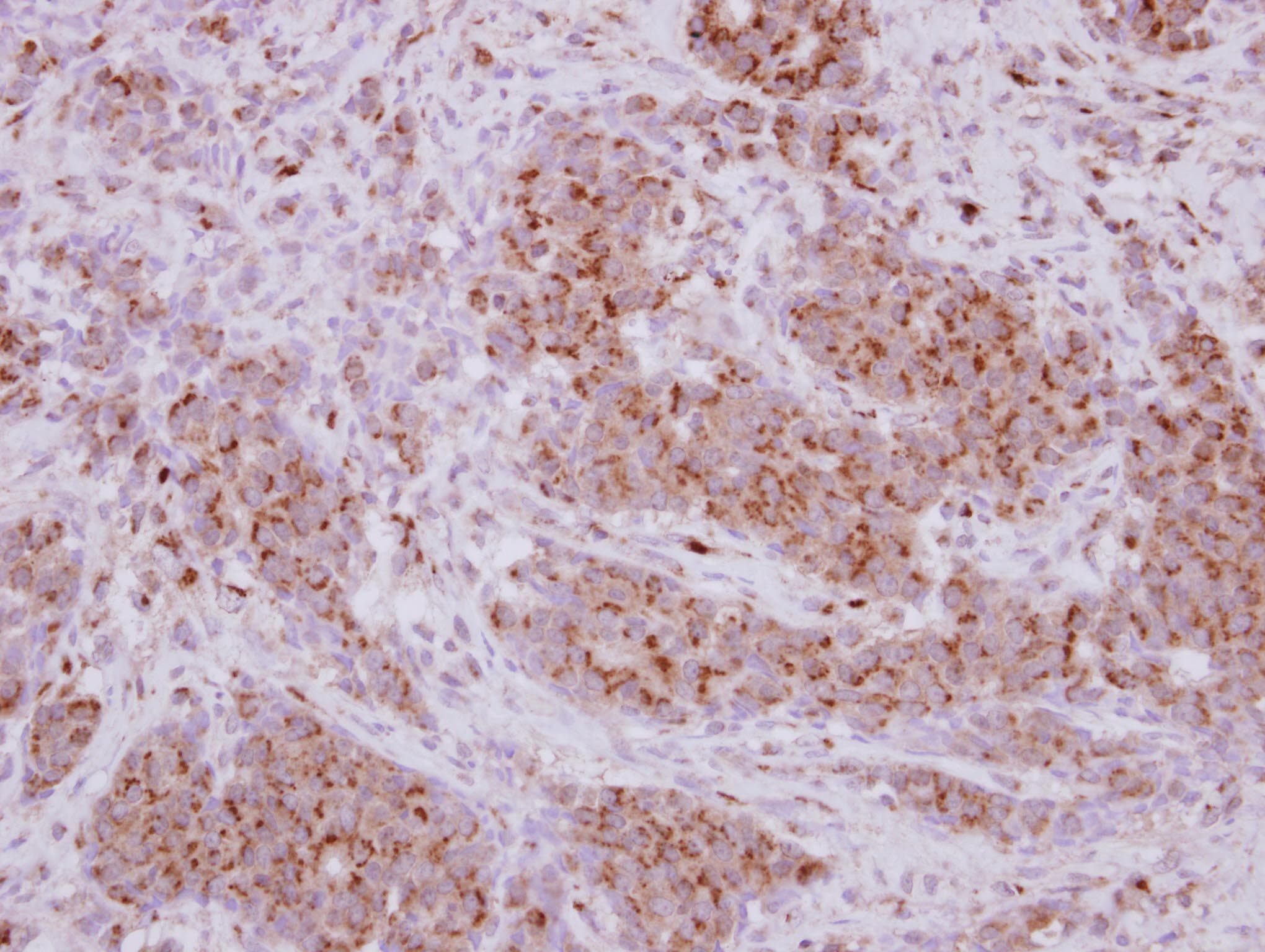 Polyclonal Rabbit anti-Human PRELID1 Antibody (IHC, WB)