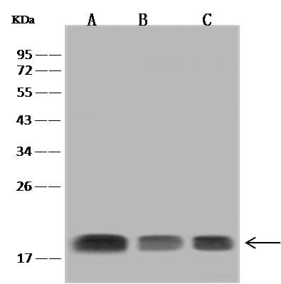 Polyclonal Rabbit anti-Human SNX3 Antibody (IHC, IF, WB)